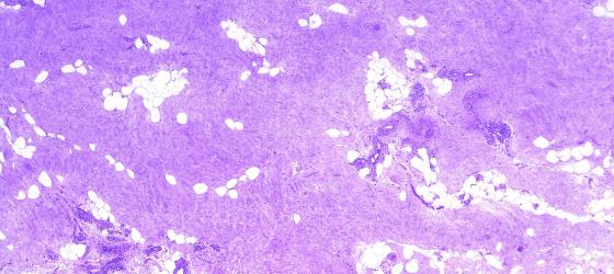 Ghiandole Perianali Del Cane: Ascesso, Infiammazione E Cure - Foto 8